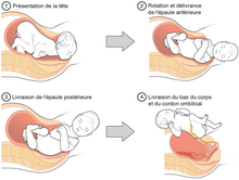 découvrez les méthodes alternatives d'accouchement pour vivre une expérience de naissance harmonieuse et adaptée à vos besoins. explorez des techniques telles que l'hypnobirthing, la sophrologie, et l'accouchement dans l'eau pour un moment unique et serein.