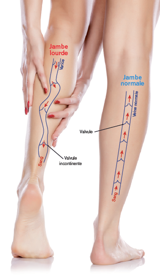 découvrez des conseils pratiques et des astuces naturelles pour alléger vos jambes lourdes durant la grossesse. apprenez comment soulager la sensation de fatigue et améliorer votre confort au quotidien.